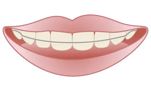 大宮駅の歯医者「アーバン歯科・矯正歯科 大宮ラクーン院」の矯正歯科は小児矯正に対応しています