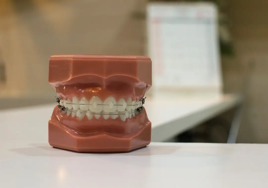 大宮駅の歯医者「アーバン歯科・矯正歯科 大宮ラクーン院」のワイヤー矯正は患者様一人ひとりにあった治療装置を使用します