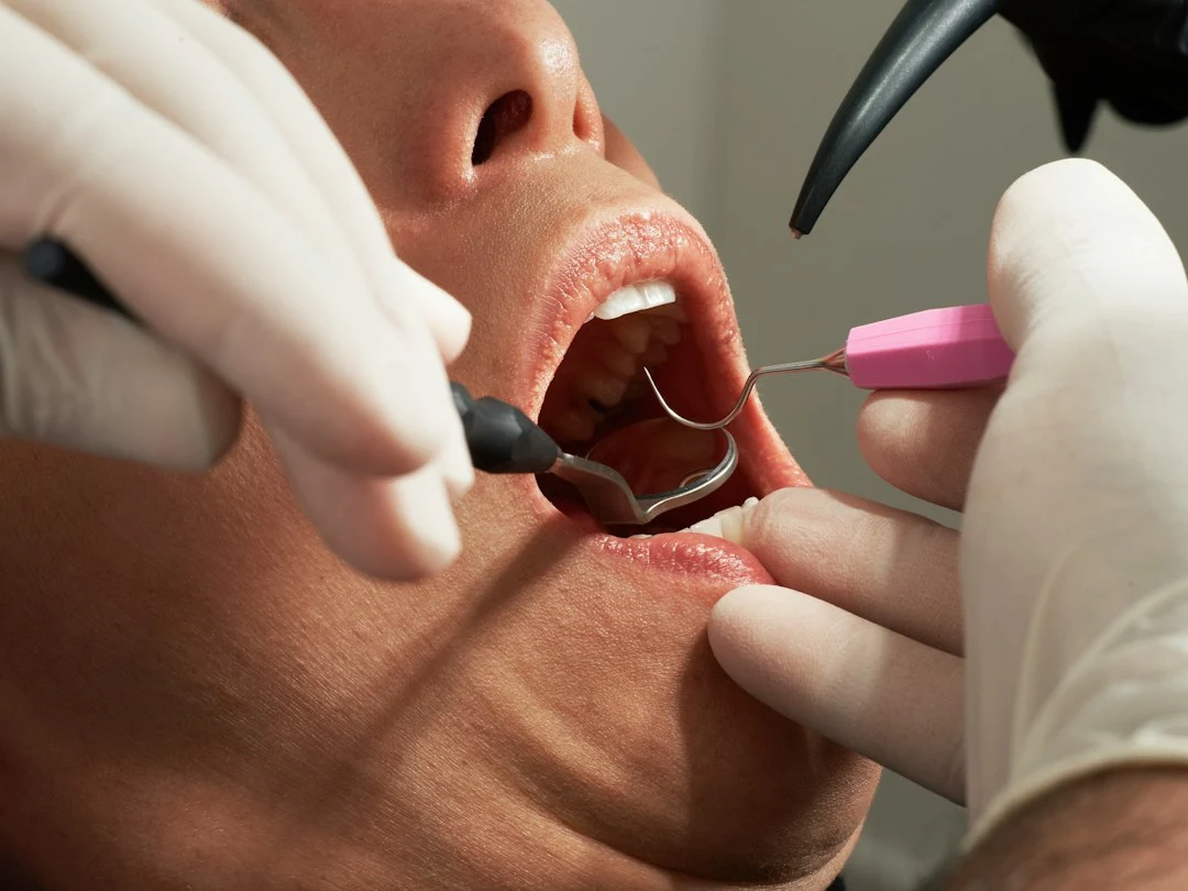 大宮駅の歯医者「アーバン歯科・矯正歯科 大宮ラクーン院」の親知らず抜歯は術前にクリーニングを行います
