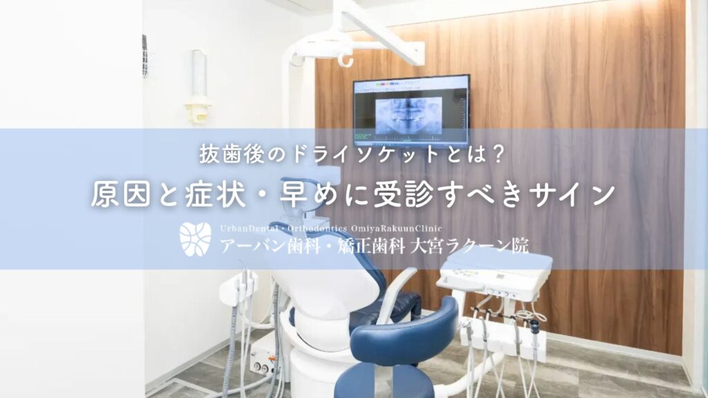 抜歯後のドライソケットとは？原因と症状・早めに受診すべきサイン