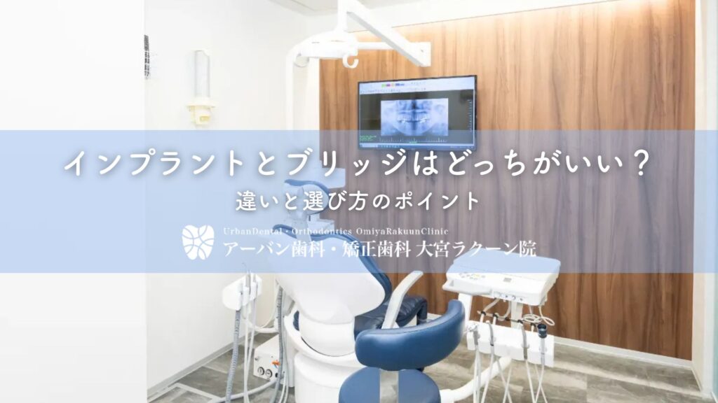インプラントとブリッジはどっちがいい？違いと選び方のポイント