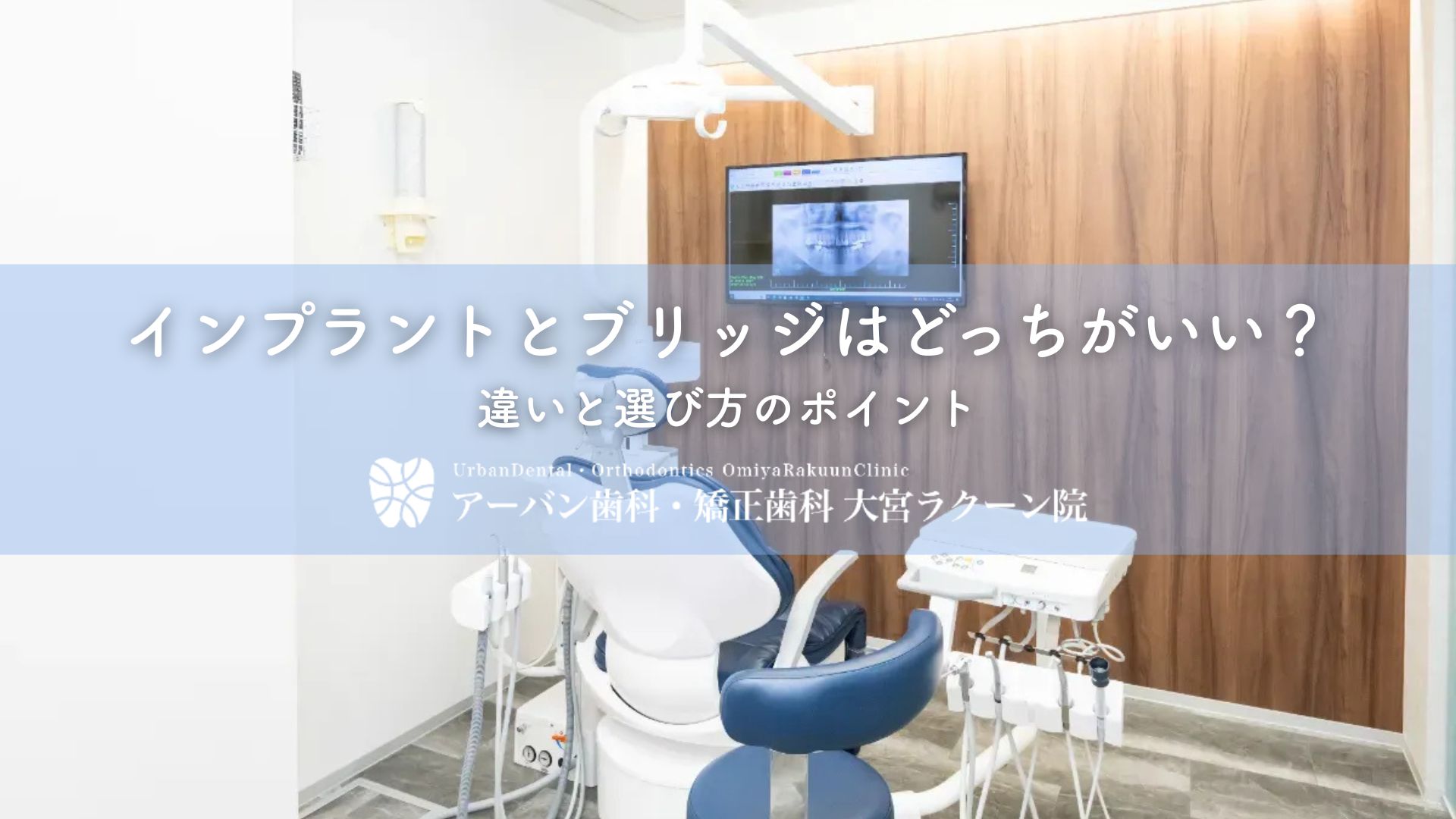 インプラントとブリッジはどっちがいい?違いと選び方のポイント