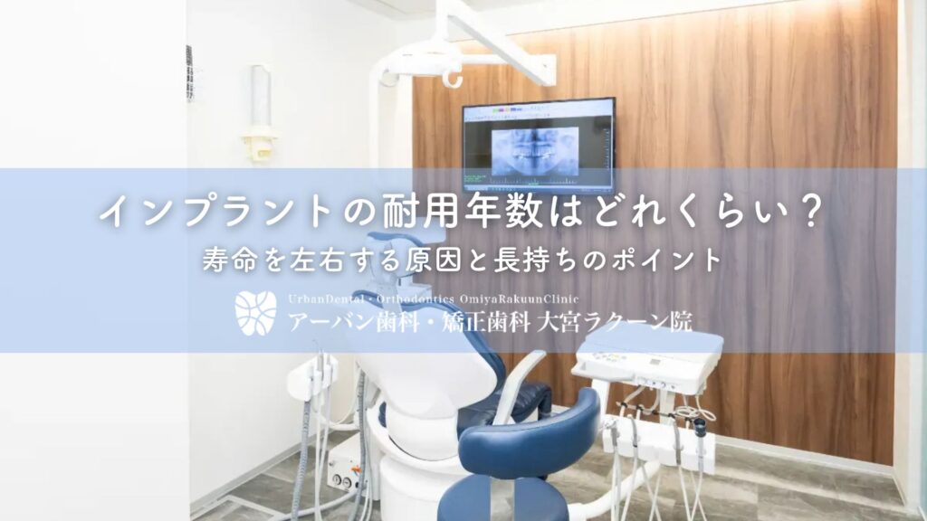 インプラントの耐用年数はどれくらい？寿命を左右する原因と長持ちのポイント