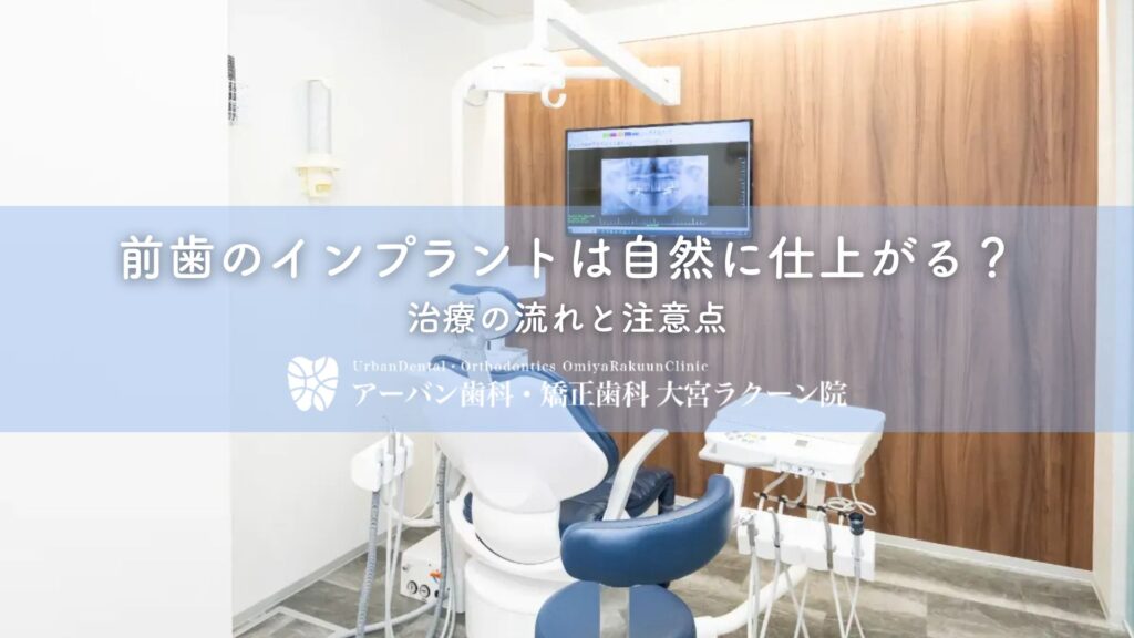 前歯のインプラントは自然に仕上がる？治療の流れと注意点