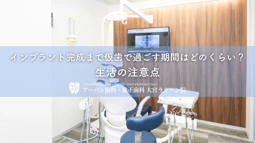 インプラント完成まで仮歯で過ごす期間はどのくらい？生活の注意点