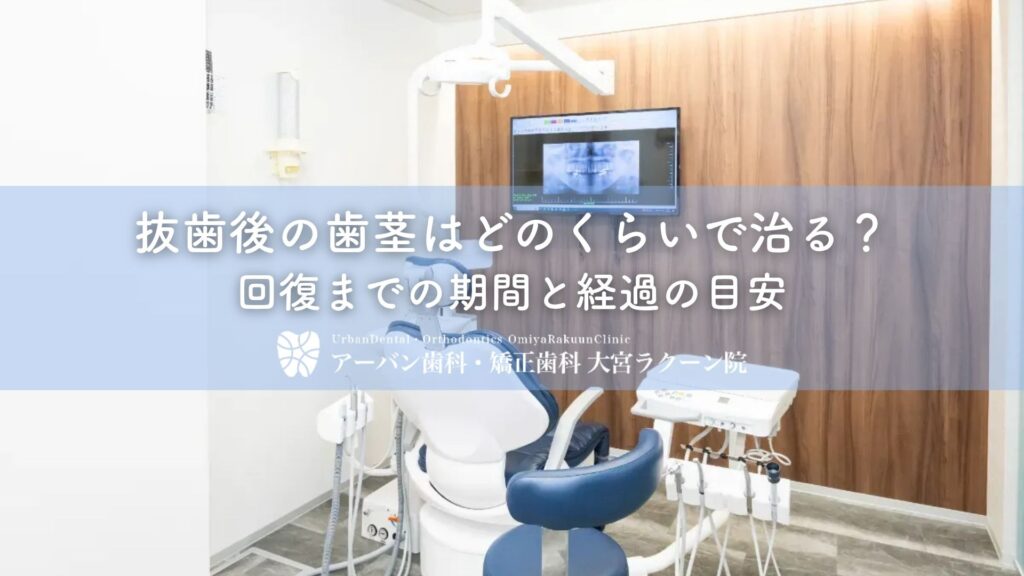 抜歯後の歯茎はどのくらいで治る？回復までの期間と経過の目安