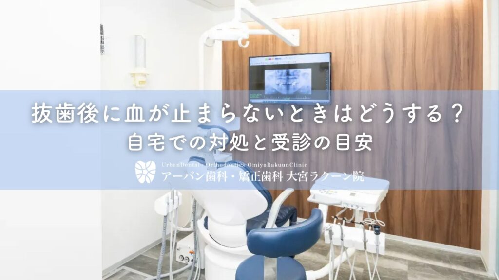 抜歯後に血が止まらないときはどうする？自宅での対処と受診の目安