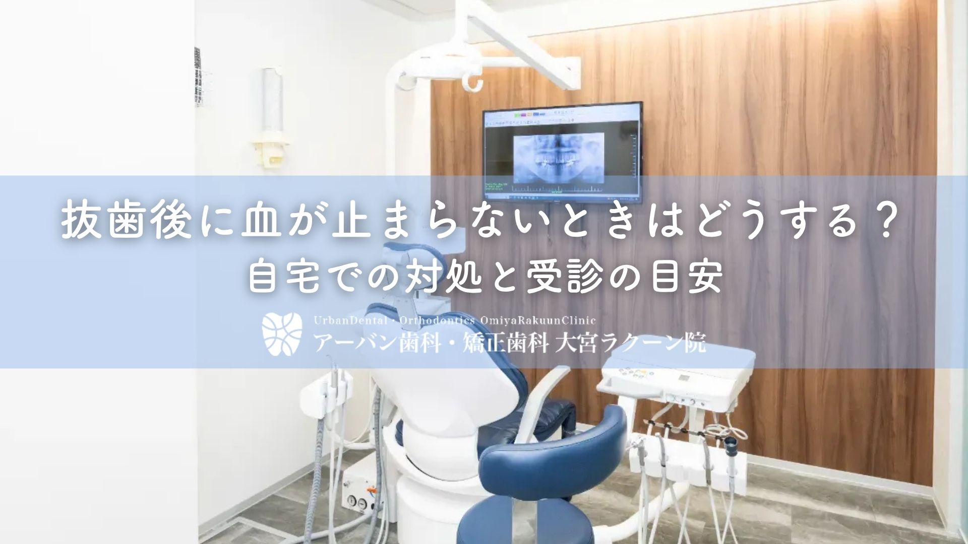 抜歯後に血が止まらないときはどうする？自宅での対処と受診の目安