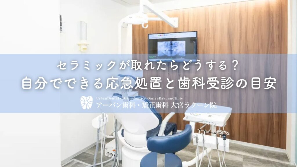 セラミックが取れたらどうする？自分でできる応急処置と歯科受診の目安
